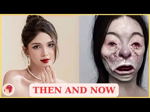 55 Celebrity Plastic Surgery Disasters Full Album | Then and Now 2025